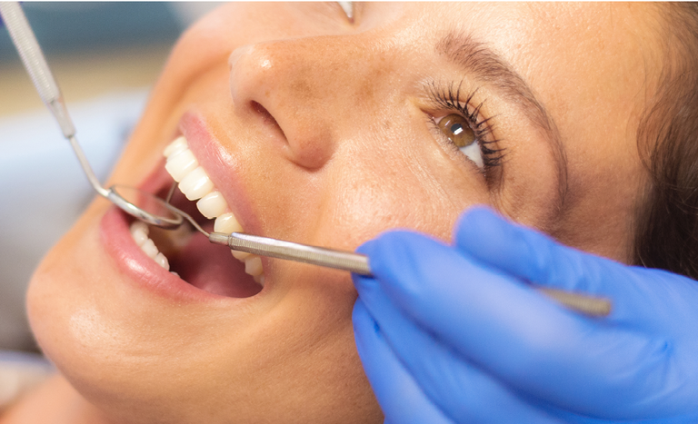 Zähne einer Frau werden vom Zahnarzt angeschaut.